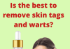 🟡💊Amarose Skin Tag Remover Review – Buy Now🟡💊 ??Amarose Skin Tag Remover Review - Buy Now??