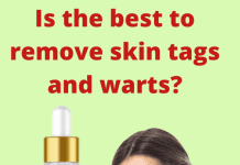 🟡💊Amarose Skin Tag Remover Review – Buy Now🟡💊 ??Amarose Skin Tag Remover Review - Buy Now??