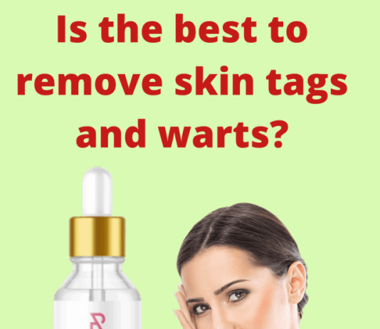 ??Amarose Skin Tag Remover Review - Buy Now??